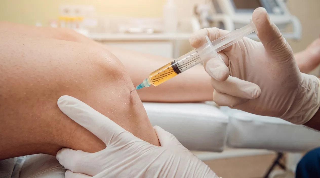 PRP Therapy
